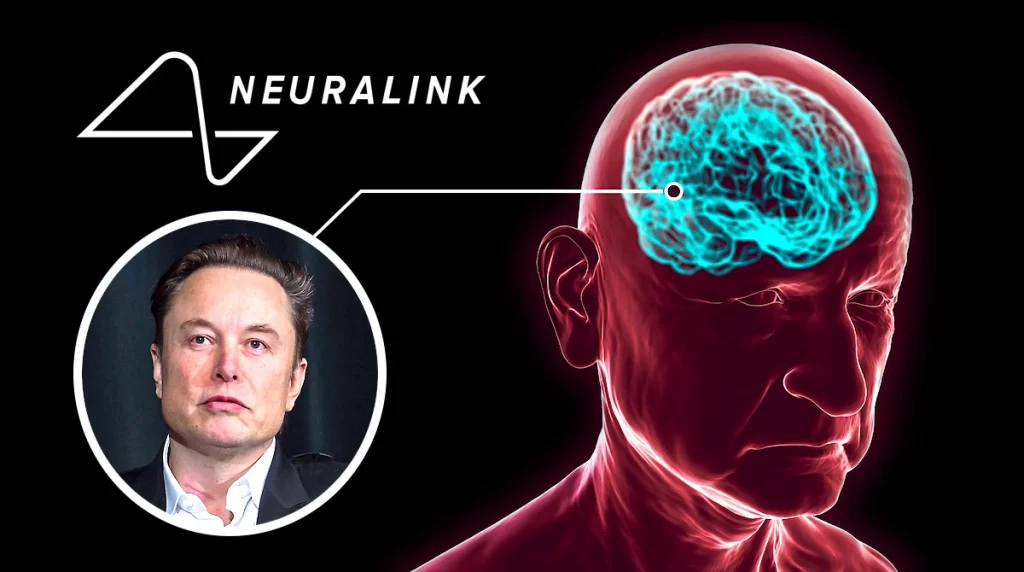 Elon Musk Neuralink Implantó El Primer Chip Cerebral En Un Ser Humano